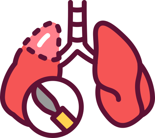 Thoracic Surgery